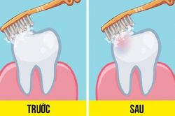 Đã có câu trả lời cho tranh cãi nên đánh răng trước hay sau khi ăn sáng