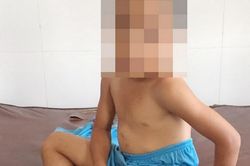Khởi tố bị can, bắt tạm giam cha dượng độc ác