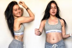 Mặt trái của xu hướng khoe khuyết điểm cơ thể