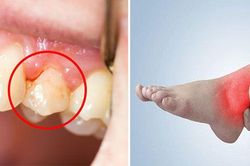 4 triệu chứng khi ngủ dậy chứng tỏ gan không tốt, cẩn thận ung thư sớm