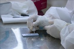 Sơn La: Khẩn trương ứng phó với ca dương tính với SARS-CoV-2
