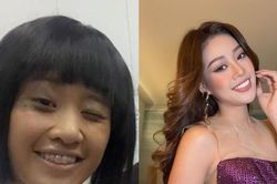 Từ Ngọc Hân đến Khánh Vân, những nàng hậu 'lột xác' nhờ phép màu mang tên niềng răng