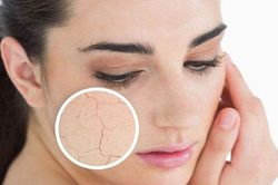 Dấu hiệu cảnh báo da lão hóa sớm bạn phải biết