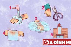 Con bị bỏng, 2 phút đầu tiên quý hơn vàng cha mẹ cần phải xử lý ngay lập tức