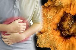 Ung thư dạ dày từ món ăn 'sở trường', 90% người Việt đều mắc phải sai lầm khi ăn món này