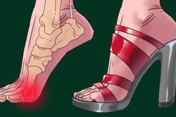 Đi giày cao gót nhiều, tập ngay 5 động tác này để đôi chân không biến dạng