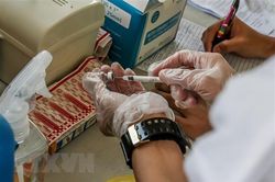 Chính phủ Lào cấm sử dụng vaccine COVID-19 cho mục đích thương mại