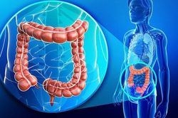 Ăn gì để giảm nguy cơ mắc ung thư đại trực tràng?
