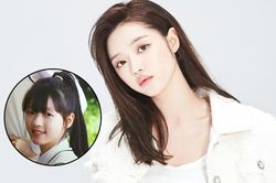 YooA (Oh My Girl) lên tiếng trước tin đồn phẫu thuật thẩm mỹ