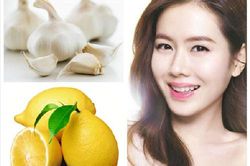 Cách trị mụn từ củ tỏi cực hiệu quả bạn đã biết chưa?