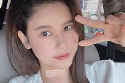Trương Quỳnh Anh vừa phẫu thuật tuyến giáp, hé lộ tình hình hiện tại