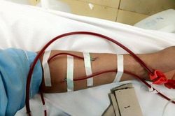 Người bệnh lọc máu cần được quan tâm đặc biệt trong đại dịch COVID-19