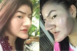 Cô gái khoe gương mặt với với chiếc mũi và cằm nhọn hoắt gây sốc dân mạng