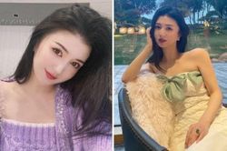 Nữ ca sỹ Trung Quốc tử vong sau khi hút mỡ và nâng ngực