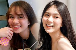 Cô gái 'dằn mặt' người yêu cũ khi gỡ bỏ 8 chiếc răng