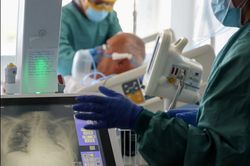 Các bác sĩ so sánh biến thể Delta lây lan như 'cháy rừng'
