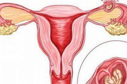Thai góc tử cung, phẫu thuật ngay tránh nguy hiểm tính mạng