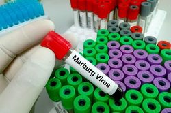 Lo ngại người tử vong vì virus họ hàng của Ebola đã lây cho 155 người khác