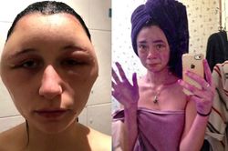 Cười ra nước mắt với loạt tai nạn khó đỡ khi tự nhuộm tóc tại nhà