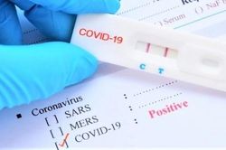 Covid-19 ở Việt Nam sáng 23/8: 737 ca tử vong trong 48 giờ; Thần tốc xét nghiệm toàn TP. HCM; Bình Dương đã ở đỉnh dịch; HCDC hướng dẫn tự test nhanh
