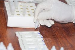 Trưa 27/8, Hà Nội có thêm 32 ca mắc COVID-19
