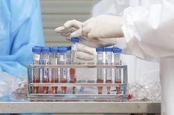 Chiều 28/8, Hà Nội ghi nhận 21 ca mắc Covid-19