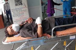Mâu thuẫn với đối tượng ngồi trên xe khách chở F0 đi cách ly, một người đàn ông bị chém lìa tay