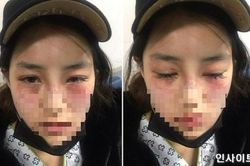 Bi kịch của những cô gái Hàn yêu đàn ông vũ phu