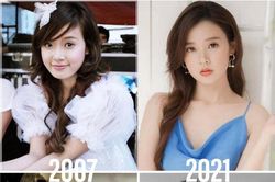 Bị đồn 'dao kéo', ngọc nữ Midu tung bằng chứng làm netizen gật gù