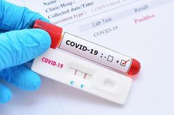 Làm giả phiếu xét nghiệm SARS-CoV-2 cho trên 100 người