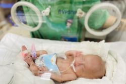 Em bé đầu tiên tại Việt Nam chỉ nặng 0,4 kg khi chào đời