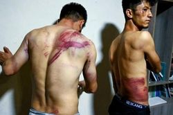 Đi đưa tin biểu tình, hai nhà báo bị Taliban đánh đập