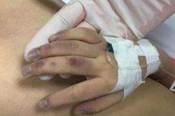 Bé gái 6 tuổi bị bố đánh trước khi tử vong