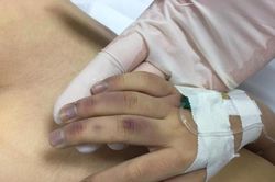 Bệnh viện Nhi Trung ương nói gì về vụ bé gái tử vong, nghi ngờ do bạo lực từ người thân?