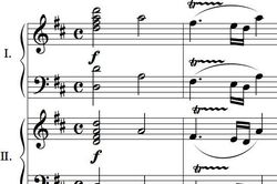 Phát hiện 'chìa khóa' trong bản nhạc của Mozart giúp xoa dịu người bệnh động kinh