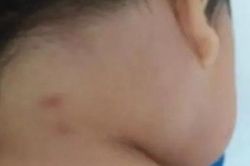Con trai bị côn trùng cắn lúc ngủ, bố mẹ 'chết lặng' khi bác sĩ báo tin con tử vong để lại bí ẩn chưa ai giải thích được
