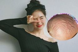 Hòa Minzy lần đầu chia sẻ hình ảnh rạn da khi mang thai, netizen xúc động: 'Thương lắm những người mẹ'