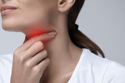3 sai lầm cần tránh khi sử dụng thuốc chữa viêm họng