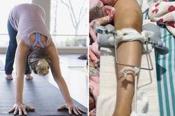 Cố 'giúp' tập động tác thật chuẩn, giáo viên yoga ở Trung Quốc làm gãy xương đùi học viên