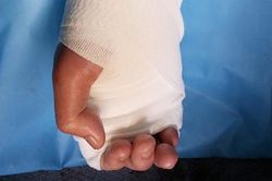 Phẫu thuật xuyên đêm cứu bàn tay đứt lìa cho thiếu niên 17 tuổi