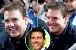 Mặt Tom Cruise sưng phù, fan nghi tiêm filler