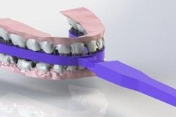 Bàn chải chống sâu răng cho trẻ em