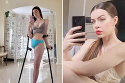 Người mẫu một chân lấy lại tự tin nhờ mạng xã hội