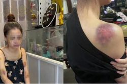 Công an truy tìm người đàn ông đánh vợ bầm dập