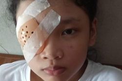 Nữ sinh 12 tuổi vỡ mạch máu mắt vì nhìn màn hình điện thoại 8 tiếng mỗi ngày trong thời gian dài