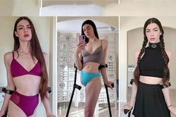 Cô gái mất chân trở thành người mẫu nổi tiếng và câu chuyện truyền cảm hứng