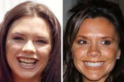 Khuyết điểm nhỏ trên mặt mà khiến các chị đẹp Hollywood điêu đứng nhan sắc