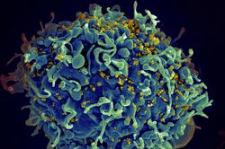 Phát hiện người thứ hai tự khỏi HIV