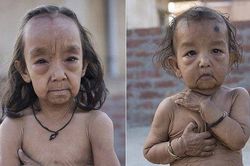 Hai chị em 7 và 18 tháng tuổi mang gương mặt già hơn cả cha mẹ, cuộc sống mỗi ngày gây xót xa