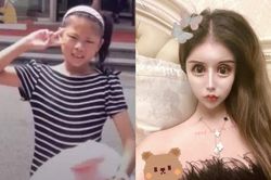 Rich kid Thượng Hải chi 13 tỷ phẫu thuật thẩm mỹ 60 lần, kết quả nhận về như mặt rắn